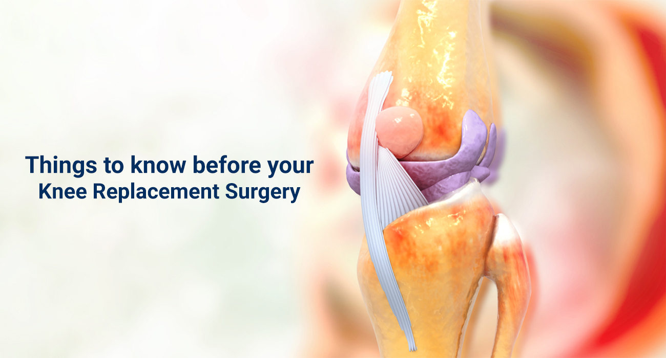 Things to know before your Knee Replacement Surgery